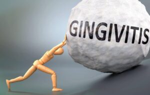 Can You Reverse Gingival Recession