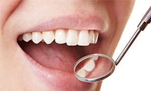 White Fillings
